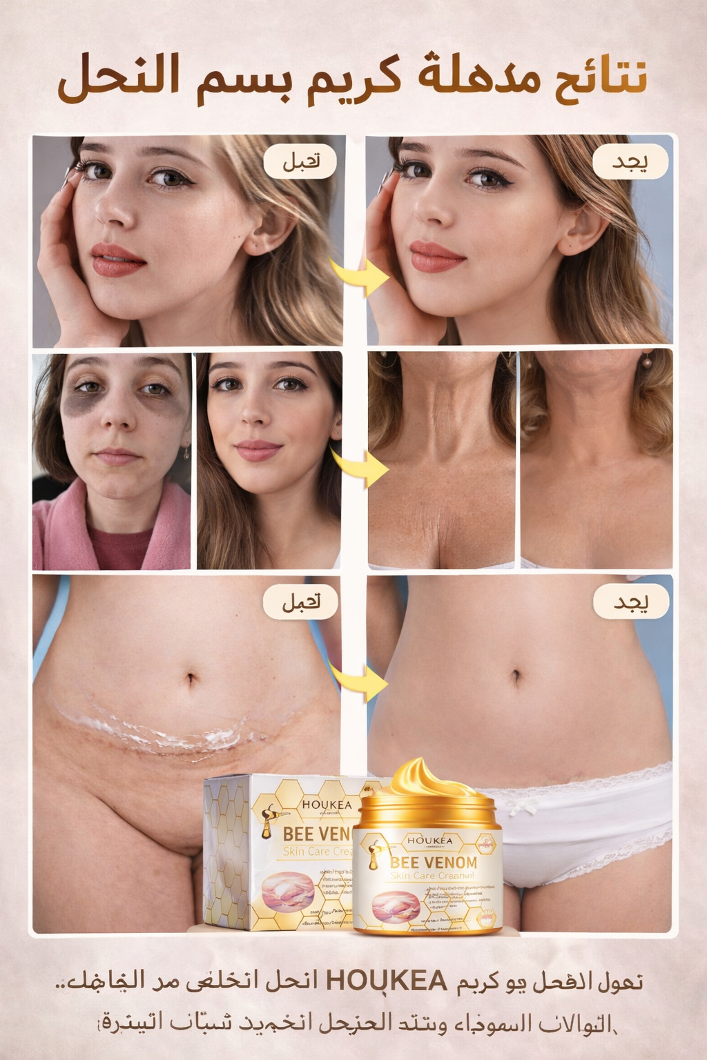 HOUKEA - Bee Venom Skin Care Cream